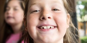 young girls smiling needs orthodontics