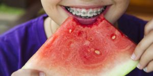 girl eating soft food melon while wearing braces
